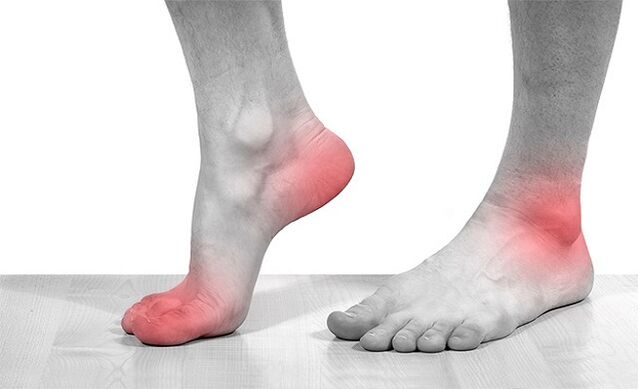 nyeri dina sendi ankle kalawan arthrosis