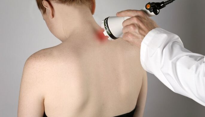 terapi laser pikeun osteochondrosis cervical