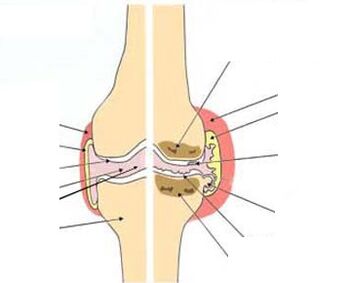 nyokot mandi turpentine jeung pinus
